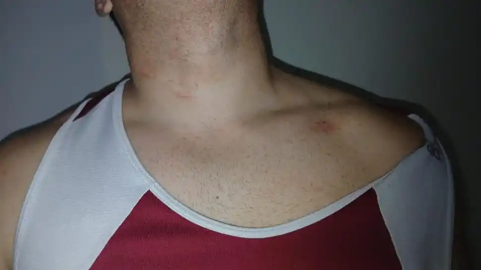 DAÑO. Sergio dijo que no puede trabajar debido a su fractura en la muñeca.