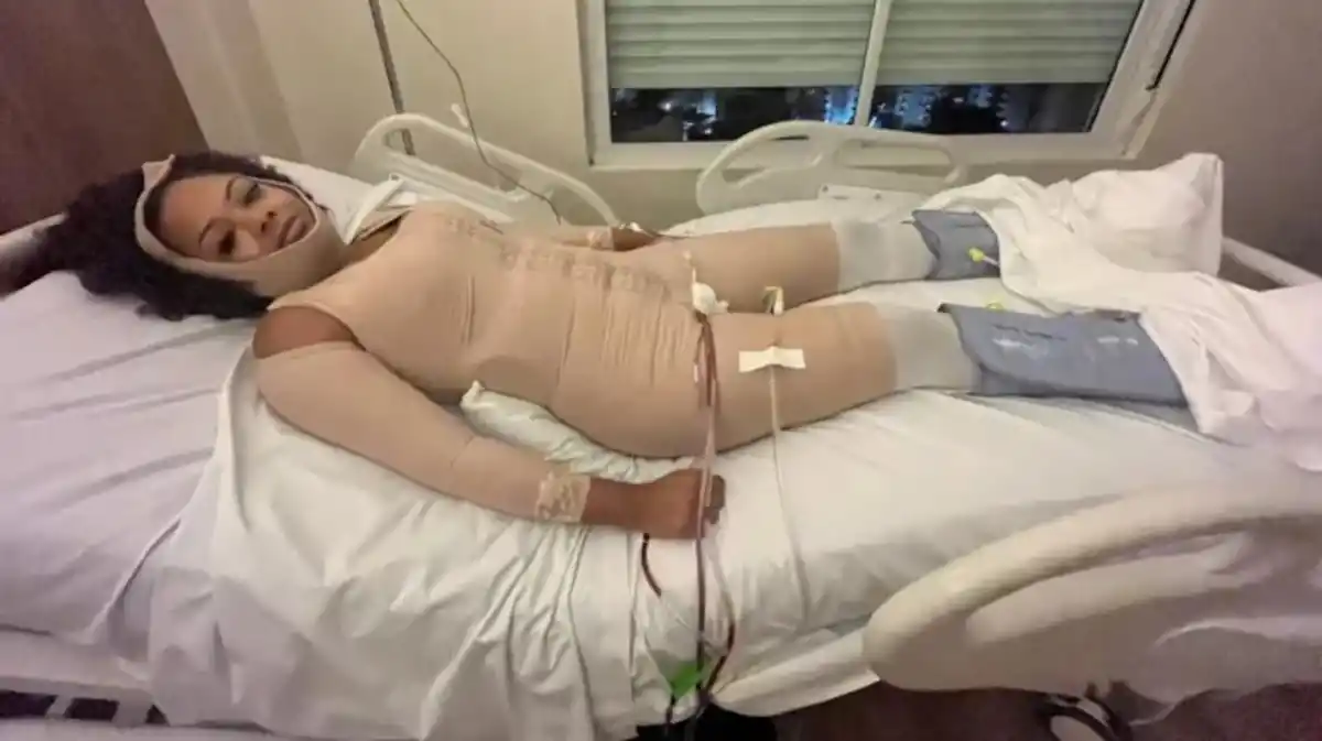 Una mujer se sometió a 12 cirugías estéticas en un solo día y terminó en terapia intensiva: condenaron al médico