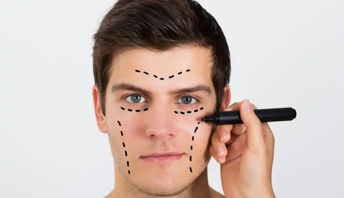 Retocarse los párpados es la cirugía estética más popular entre lo hombres