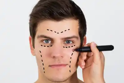 Retocarse los párpados es la cirugía estética más popular entre lo hombres