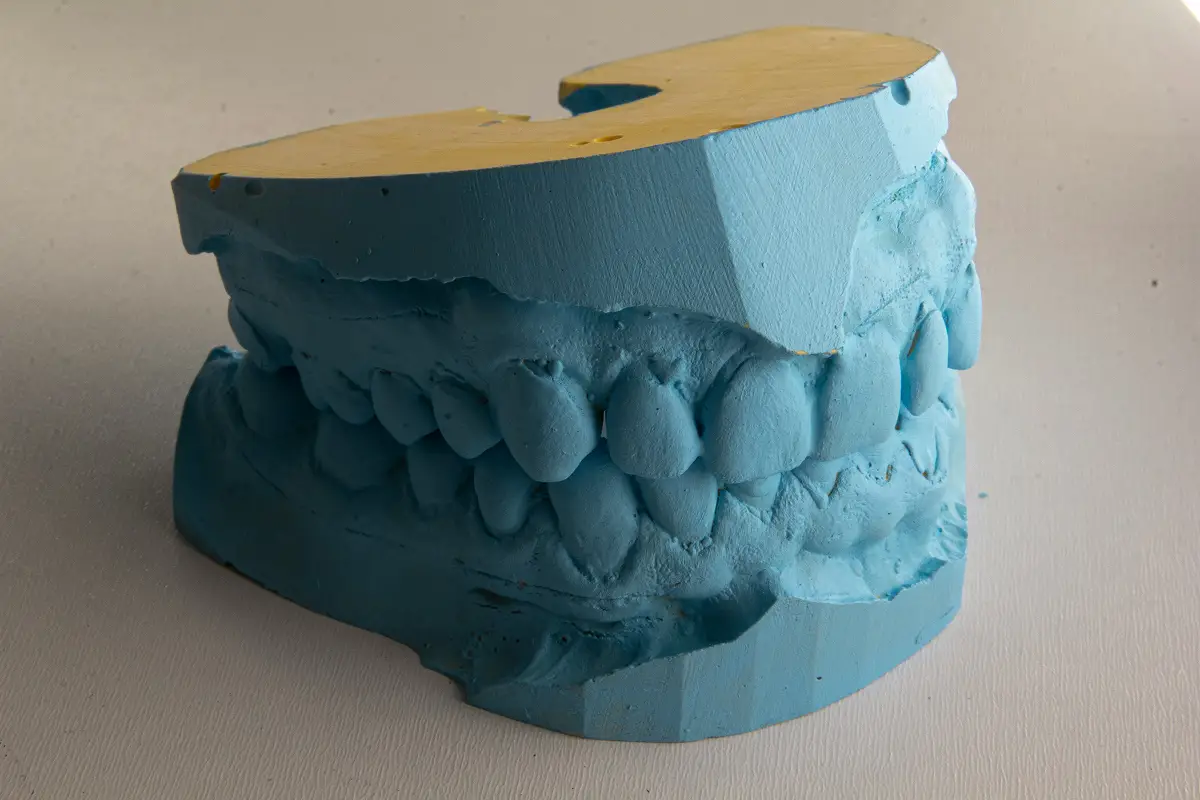 SALUD BUCAL. La Facultad de Odontología de la UNT ofrece un servicio de asistencia comunitaria con un costo mínimo.