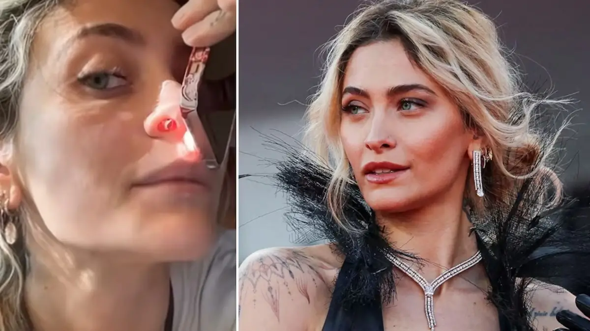Paris Jackson mostró el “hueco en la nariz” que le dejó el abuso de drogas: Podría pasar un fideo