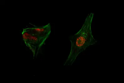 Científicos argentinos tuvieron éxito en las primeras pruebas para eliminar la metástasis del cáncer colorrectal