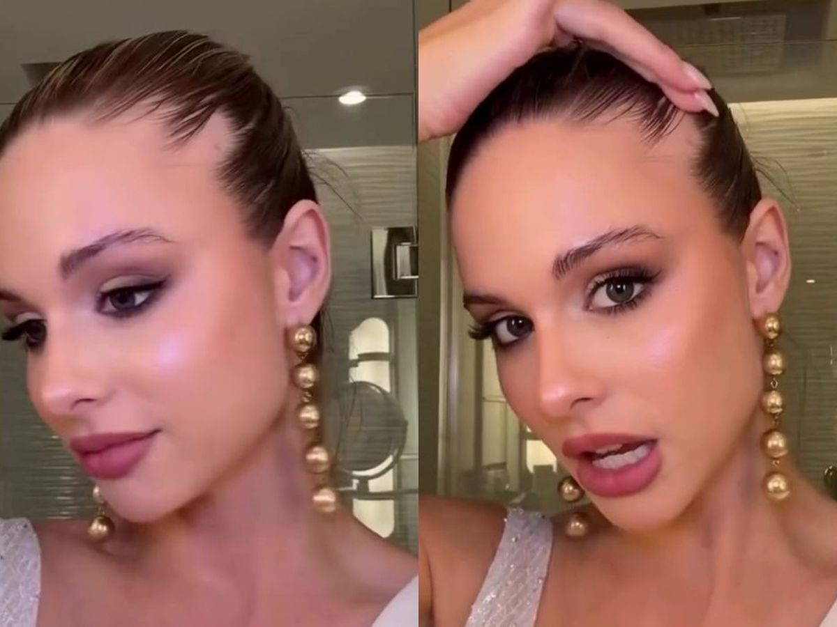 Aldana Masset, la candidata argentina a Miss Universo 2025, contó que padece alopecia