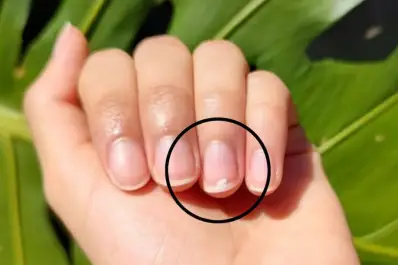 Manchas blancas en las uñas: qué significan realmente y por qué aparecen