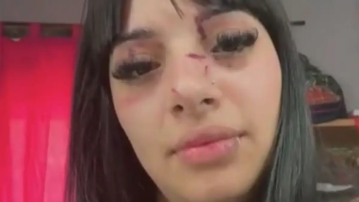 Sos la de TikTok: una joven fue atacada por linda a la salida de un boliche en Buenos Aires