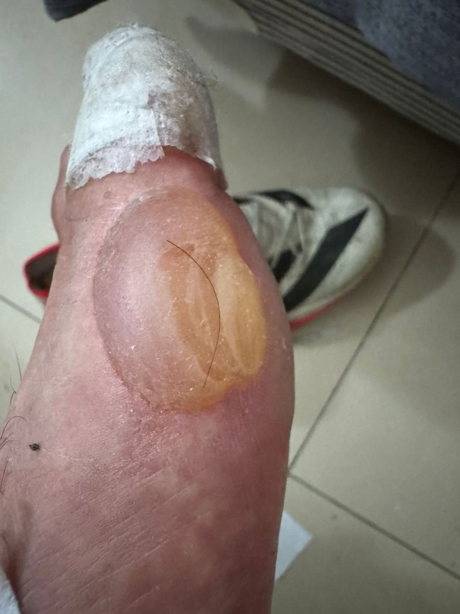 El pie de Rodríguez, con la secuelas de la competencia. 