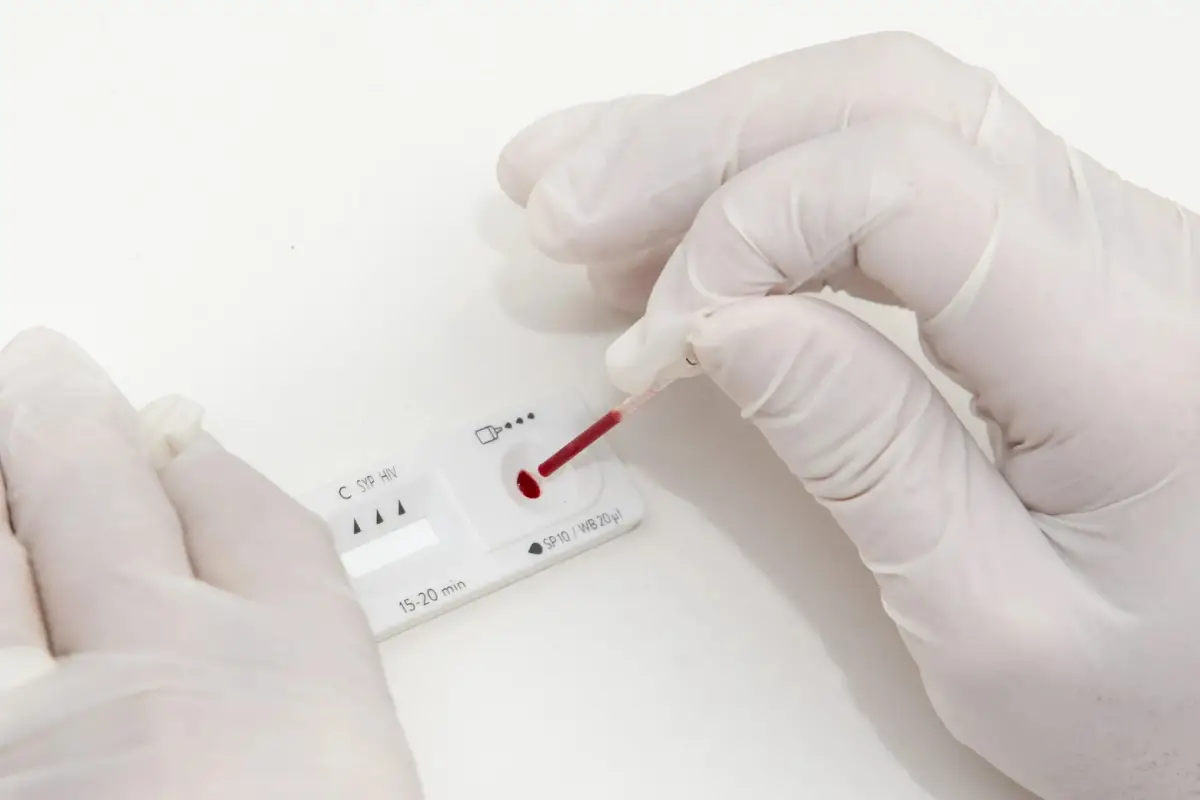 RÁPIDO. Los test para conocer el diagnóstico de esta enfermedad tardan 30 minutos y se recomienda hacerlos anualmente.