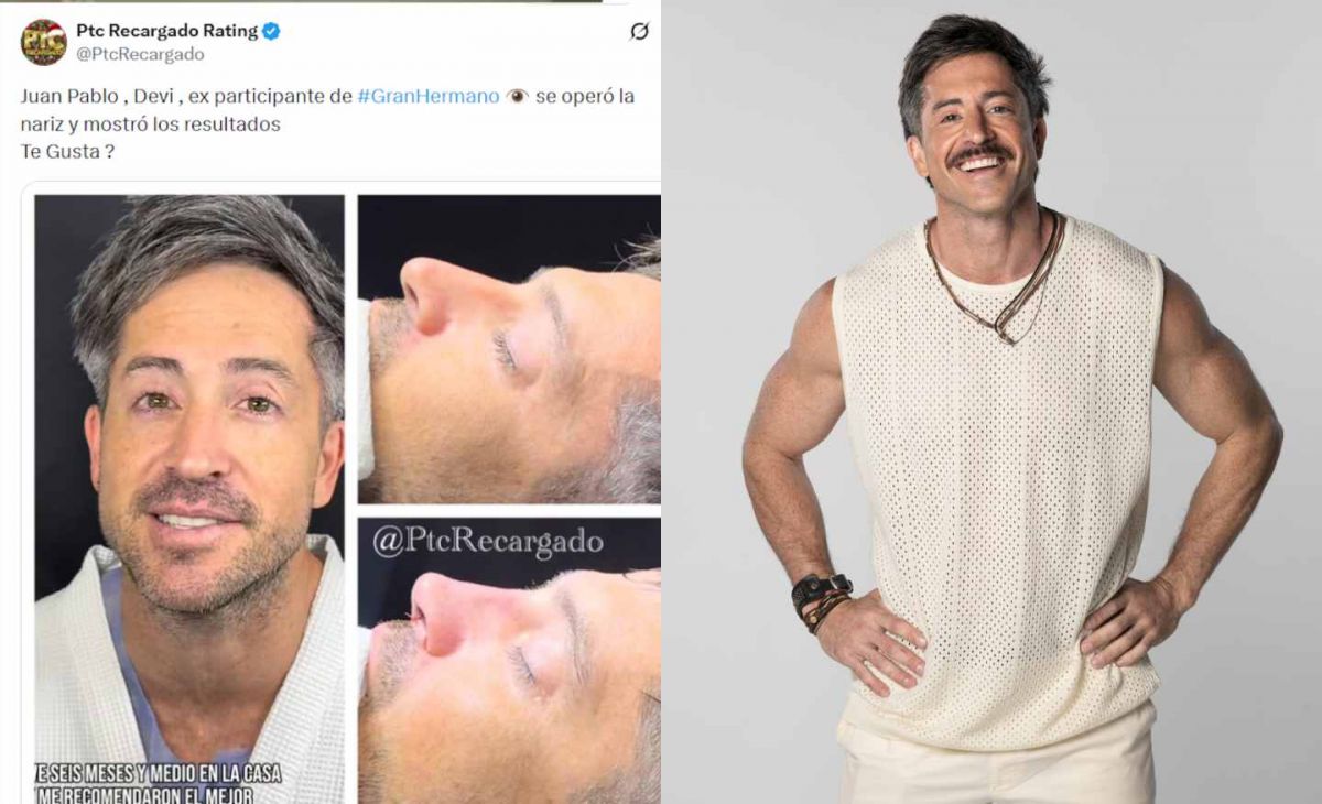 Impacto en las redes: un ex Gran Hermano pasó por el quirófano y su cambio físico generó controversia