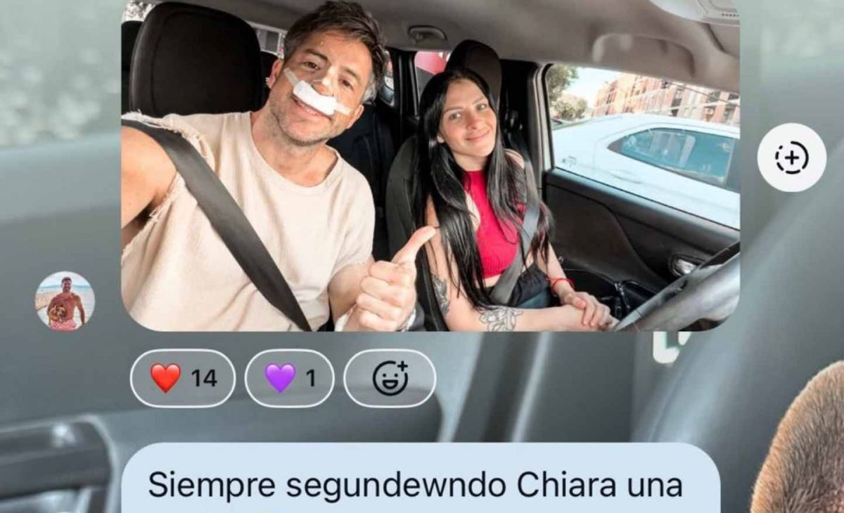 Impacto en las redes: un ex Gran Hermano pasó por el quirófano y su cambio físico generó controversia