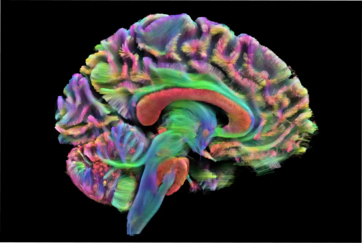 Las imágenes coloreadas del tensor de difusión revelan las vías de la materia blanca del cerebro, que transportan señales entre regiones. Al rastrear el movimiento del agua a lo largo de estas fibras, los científicos pueden mapear cómo el cableado cerebral se fortalece, se transforma y se deteriora a lo largo de la vida. Instituto de Neuroimagen e Informática Mark y Mary Stevens/Biblioteca de Fotografía Científica/National Geographic