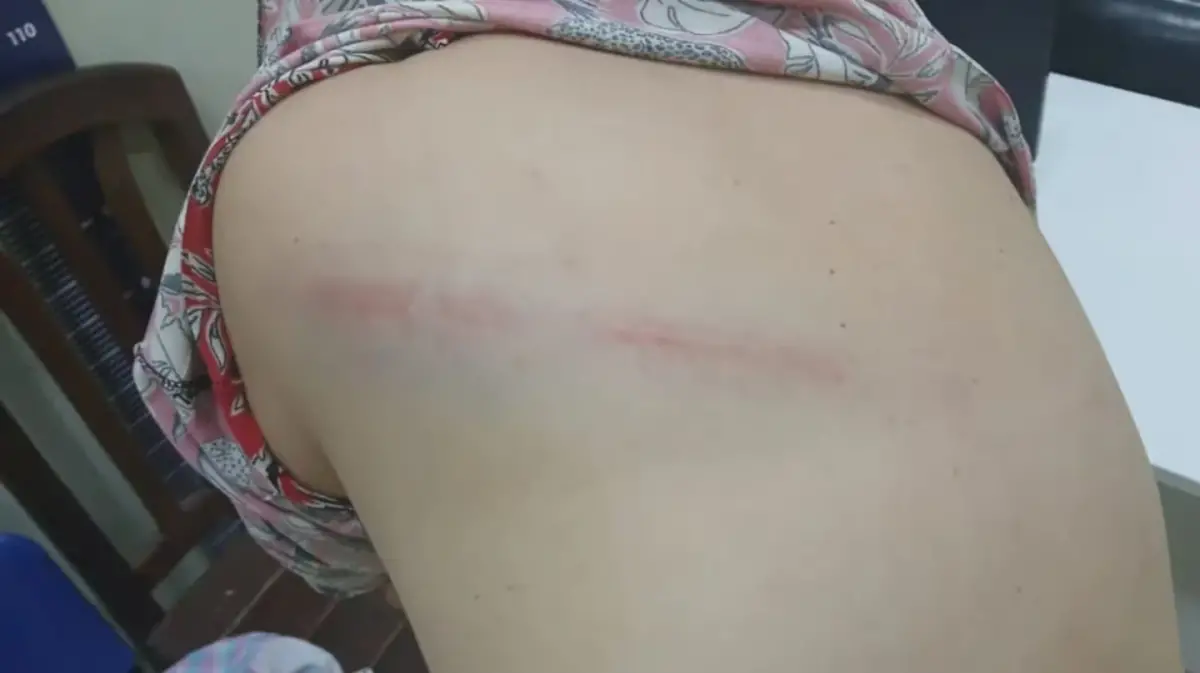 SANTIAGO DEL ESTERO. La víctima recibió atención médica y quedó bajo resguardo de familiares, con botón antipánico. 