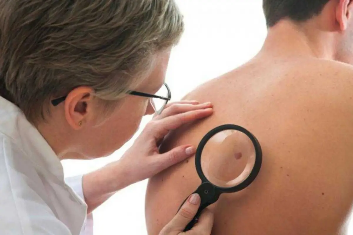 AVANCE SIGNIFICATIVO. El Hospital Italiano logró el autocultivo de piel con células de los propios pacientes.