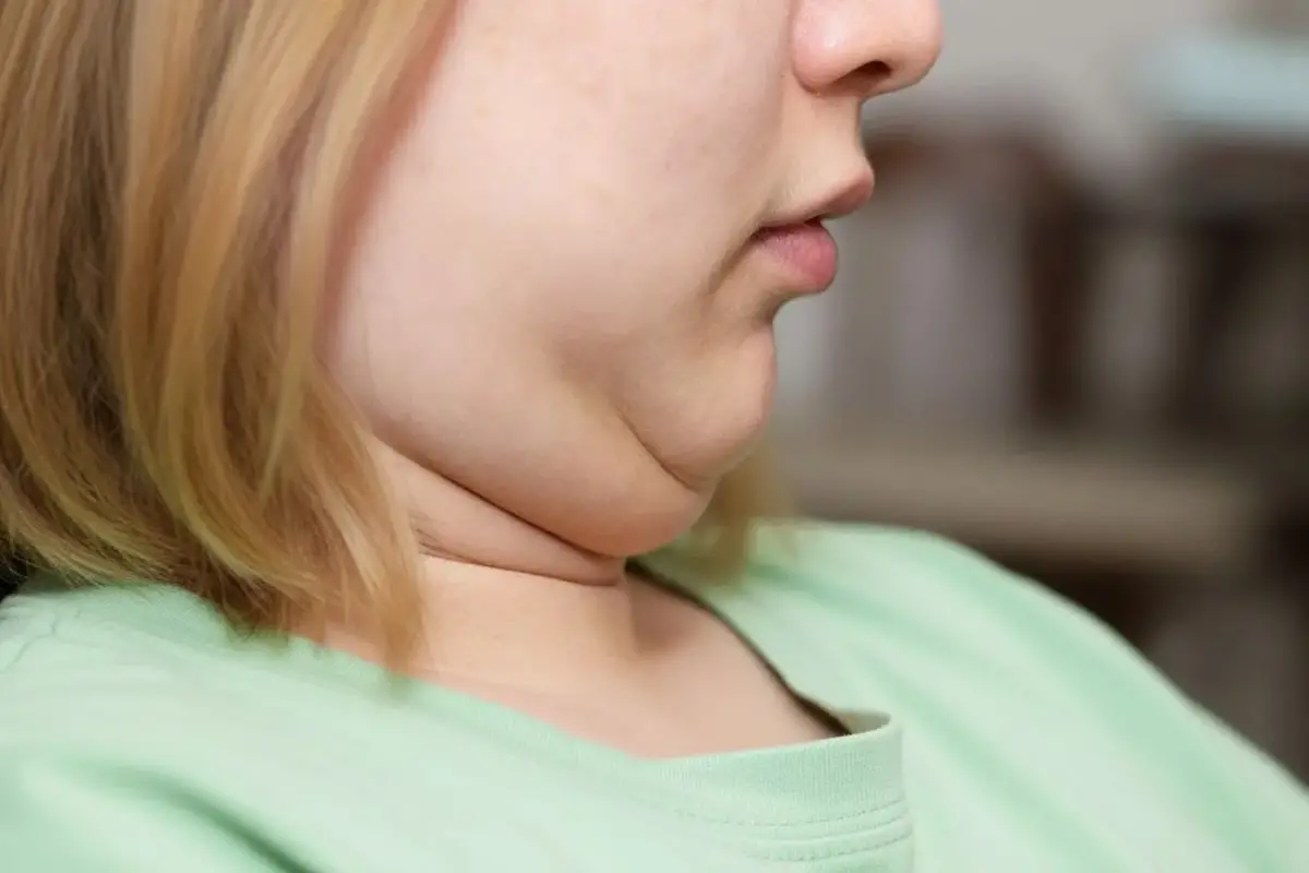 Cómo reducir la papada: los 8 ejercicios más recomendados