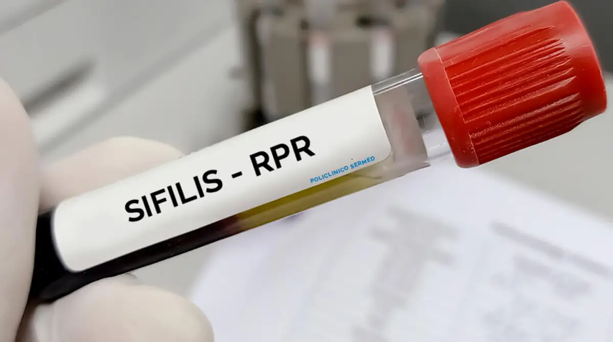 Se dispararon los casos de sífilis en Argentina. Foto: Políclinico SerMed