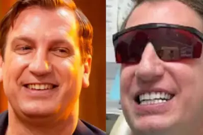 ¿Qué se hizo en la cara Maxi López?: el cambio que provocó una comparación con L-Gante