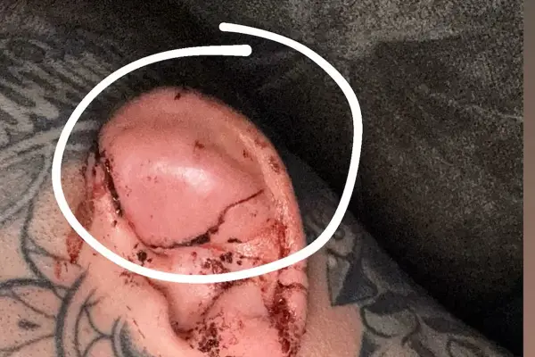 Escándalo en las MMA: Un luchador emuló a Mike Tyson y le mordió la oreja a su rival en pleno combate