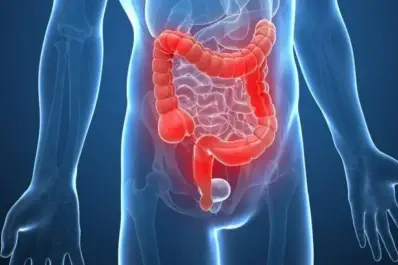 Alerta por cáncer de colon: cuáles son los síntomas tempranos y por qué la detección precoz puede salvar vidas