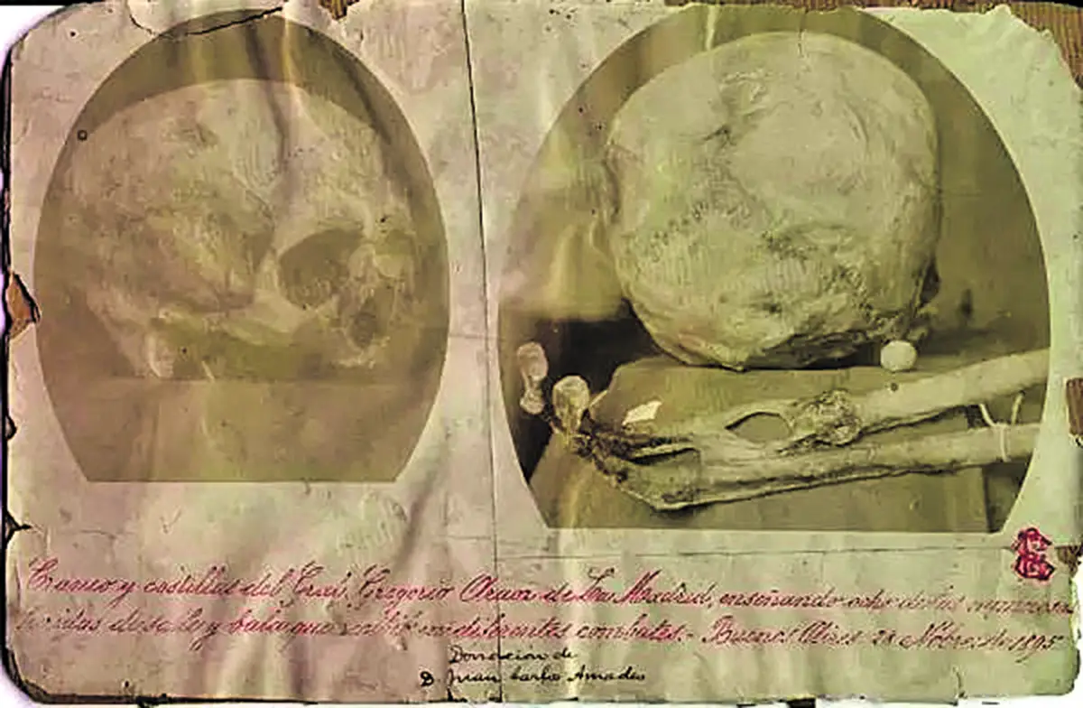 Recuerdos fotográficos: el cráneo La Madrid tenía “más cicatrices que hueso”