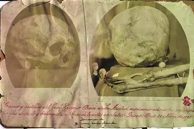 Recuerdos fotográficos: el cráneo La Madrid tenía “más cicatrices que hueso”