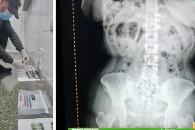 Detienen a tres “cápsuleras” que habían ingerido más de dos kilos de cocaína en Tucumán