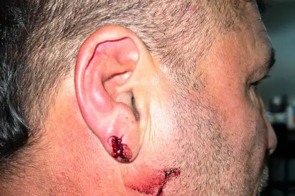 Denunciaron a Leandro Díaz por una presunta agresión a la salida del estadio