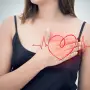 Cartas de lectores: Enfermedad cardiovascular en la mujer: cuando el corazón avisa en voz baja