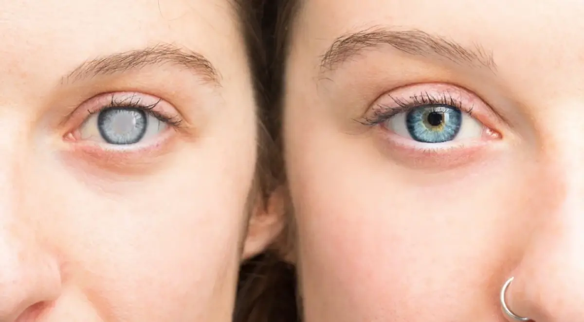 ATENCIÓN. Los ojos son los órganoz principales del sistema visual.