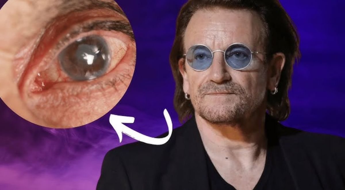 FAMOSO. Bono de U2 al ser tan famoso generó conciencia sobre la enfermedad en miles de personas que no la conocían. 