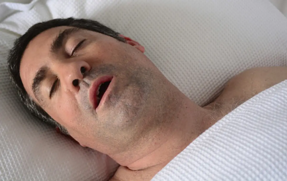 Salud del sueño: implementan una cirugía simple de paladar para reducir ronquidos