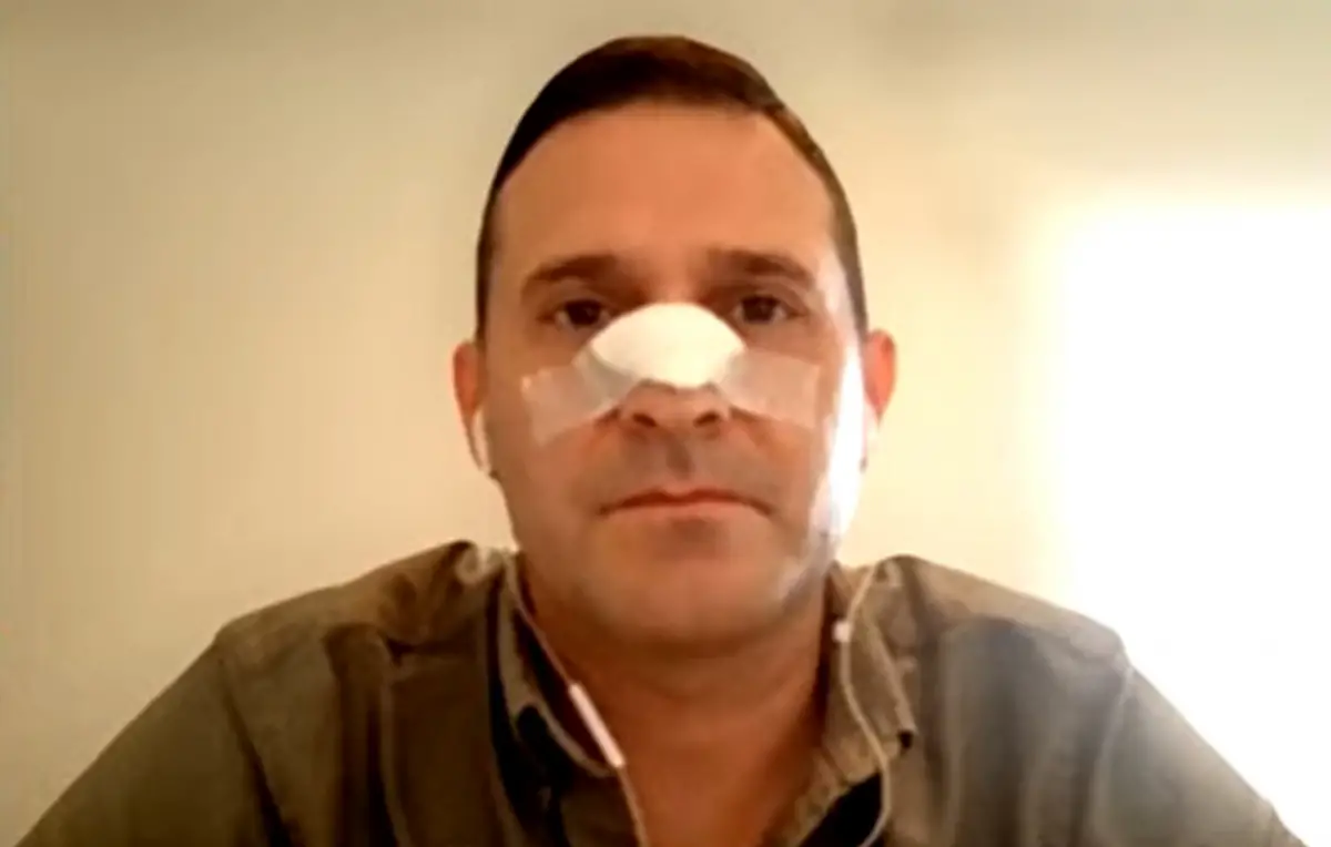 FEDERICO PELLI. El diputado nacional habló sobre su estado de salud tras la agresión sufrida.