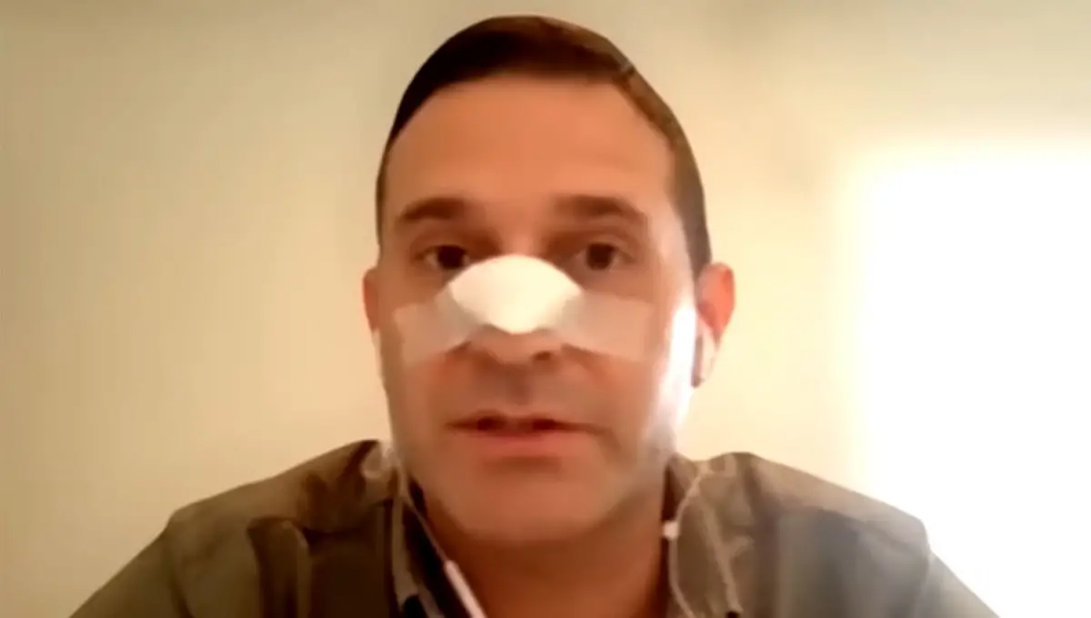 EN CONCEPCIÓN. El diputado Pelli elevó un escrito para que se investigue a los policías que formaban parte del operativo de seguridad la tarde en la que fue agredido en La Madrid.