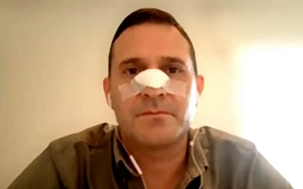 EN RECUPERACIÓN. Pelli tuvo que ser operado por el brutal golpe.