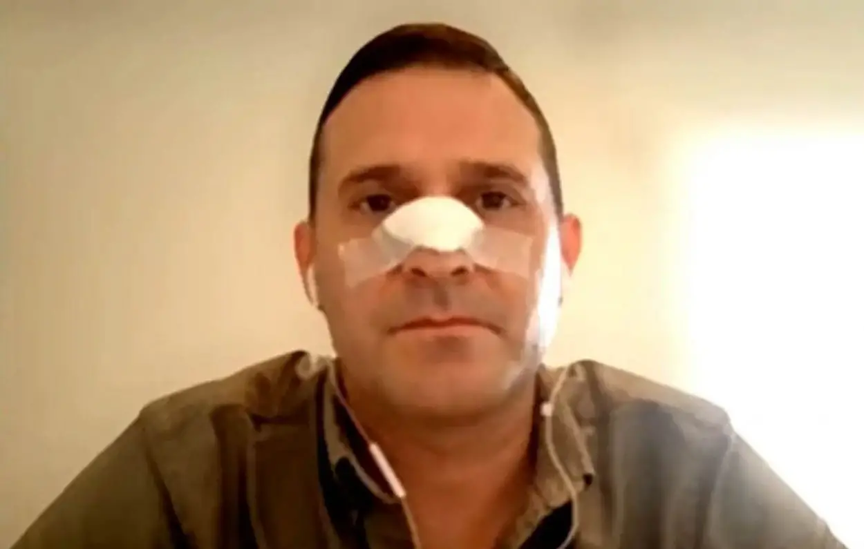 EN RECUPERACIÓN. Pelli tuvo que ser operado por el brutal golpe.