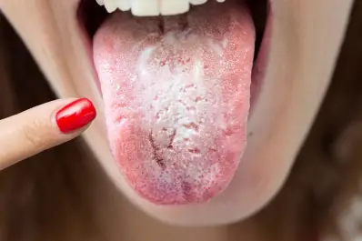 No son los dientes: cuál puede ser el origen del mal aliento a largo plazo