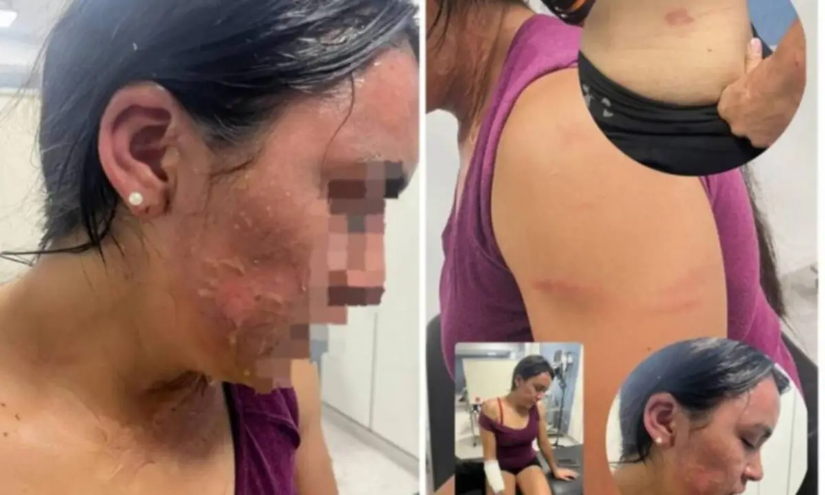 LA VÍCTIMA. Así quedó la mujer agredida. La imagen se viralizó en las redes sociales.