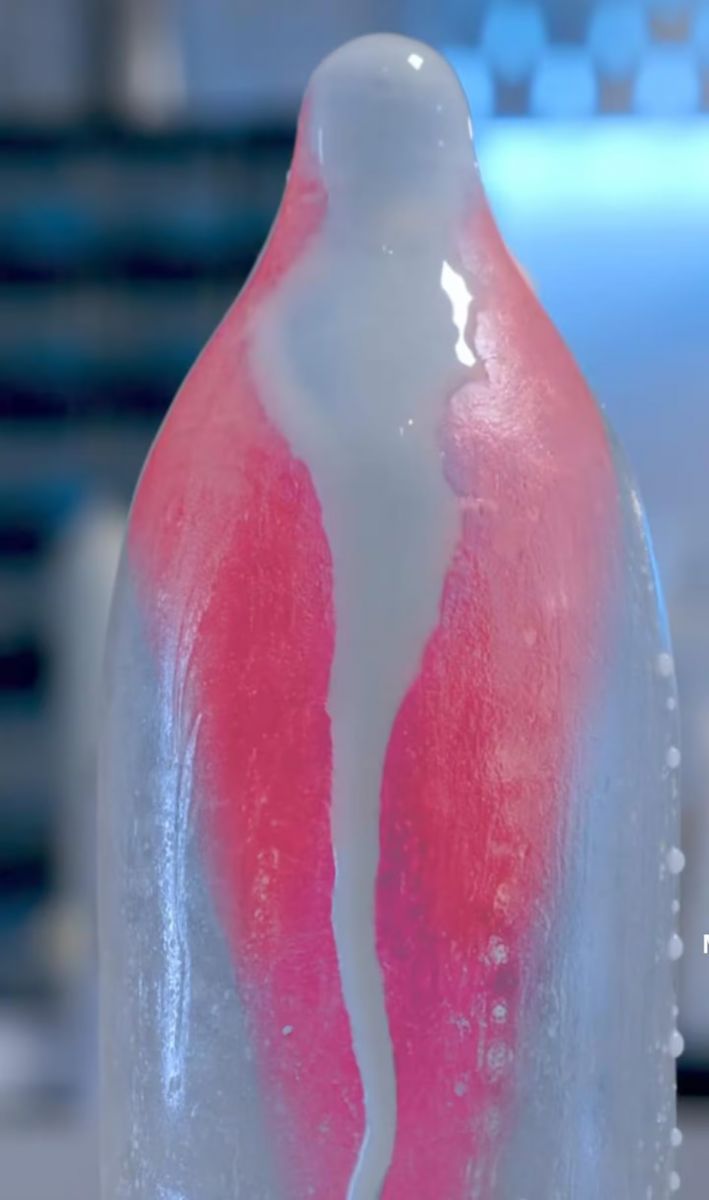 FUNCIONAMEINTO. El desarrollo aún está en fase de prueba, pero abre una nueva etapa en la prevención. / READY TOGETHER